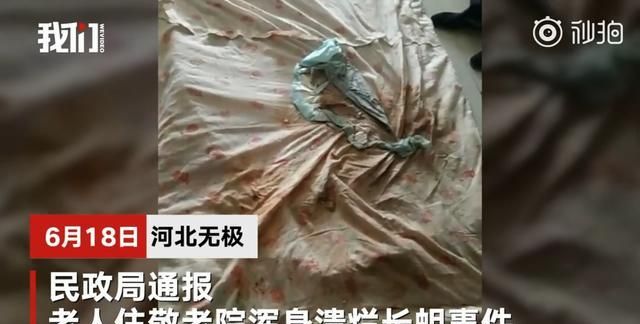 老人一生无儿儿女,住敬老院后身体溃烂长蛆,养儿防老有错吗?