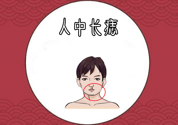 男人4颗"穷"痣留不得,必须点掉!