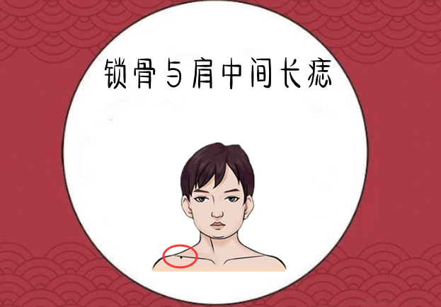 锁骨与肩中间长痣
