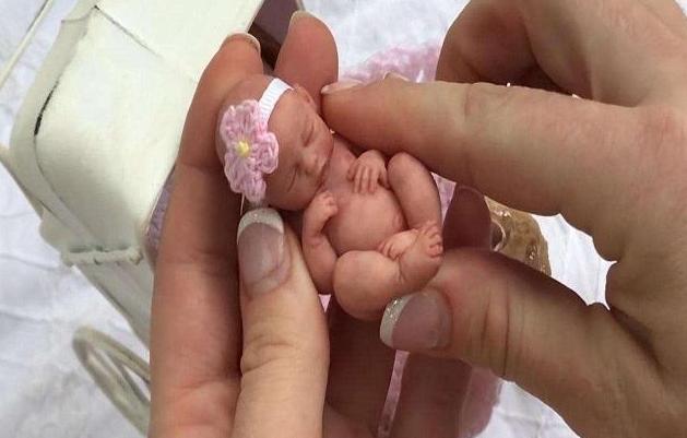 14年前的"手掌婴儿",出生仅一个手掌大小,如今怎么样了
