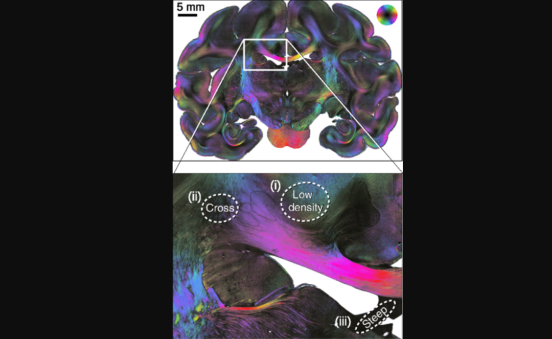 终于实现:绘制大脑神经纤维路径交叉点,创建大脑真3D不难了!