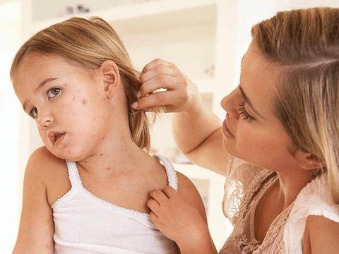 夏天，小儿荨麻疹反复发作？4个防治措施，助孩子远离荨麻疹！