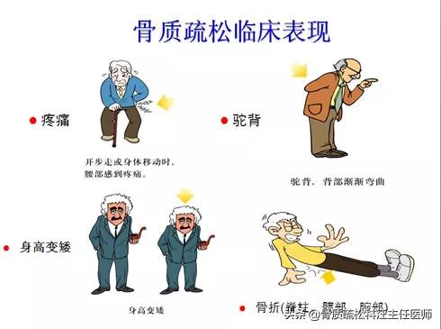 骨质疏松症与骨关节炎