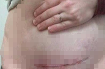 公车上老人怒骂女人,女人掀开衣服后,老人恨不得找个地洞钻进去