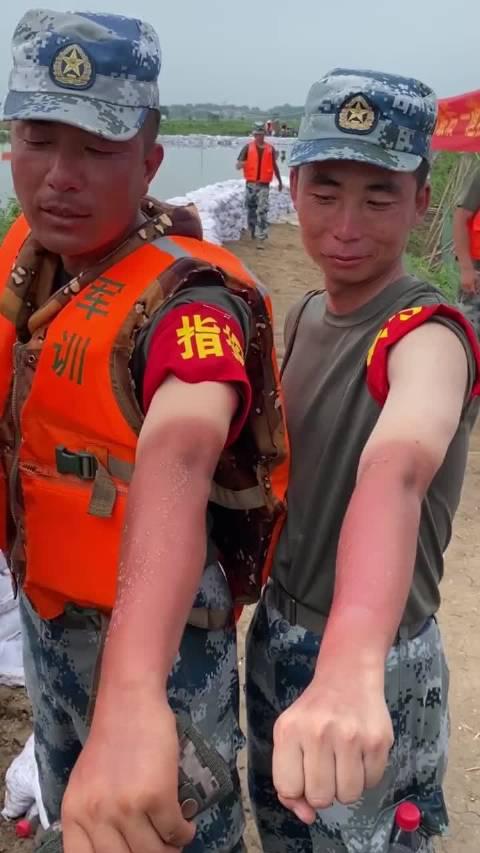 抗洪一线,许多战士被严重晒伤