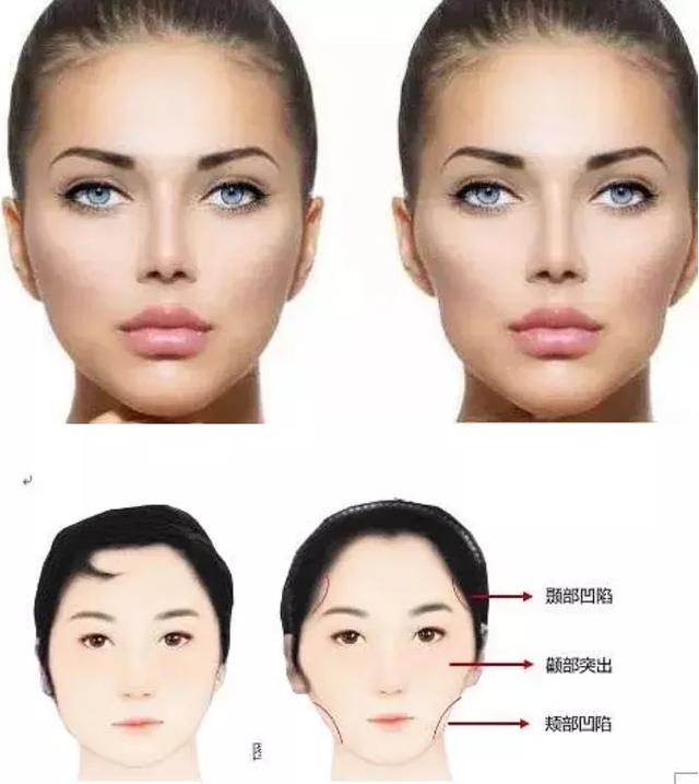 王嘉尔变成牙套脸颧骨外扩太阳穴也凹陷太多明星因此颜值骤降