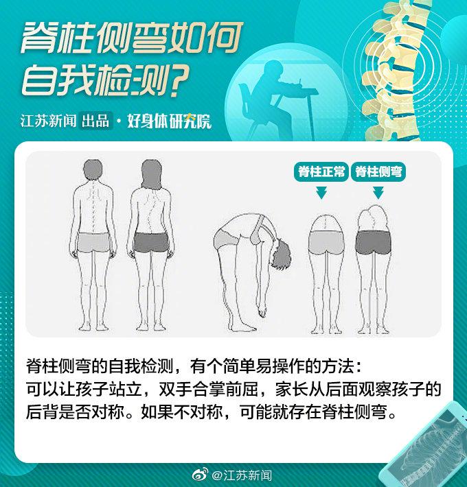 推拿,牵引,整骨能治脊柱侧弯?当心是交智商税!