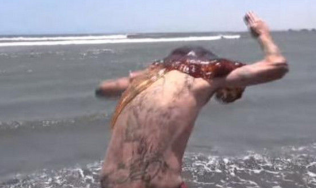 男子海边发现“宝贝”，几分钟后肩膀刺痛，哀嚎不已！
