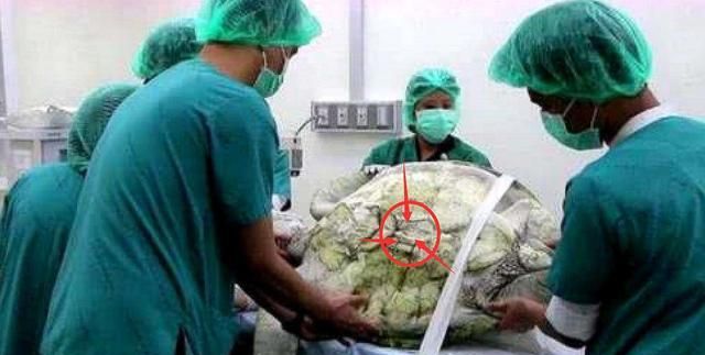 养了35年的乌龟突然去世，医生切开肚子一看，里面全是宝贝！