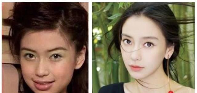 女星整容的争议很大,面对质疑,明星们也不会大方承认,不过就算整容