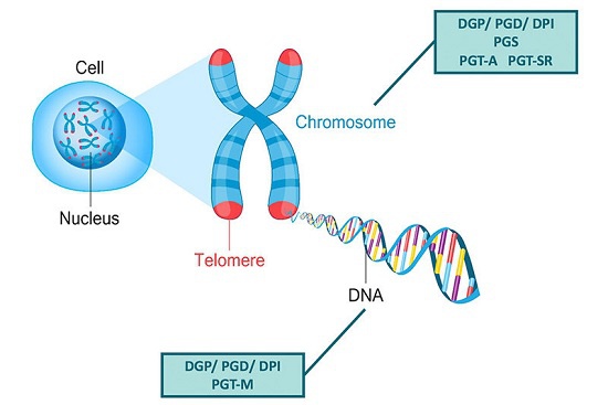 原因 染色体 異常
