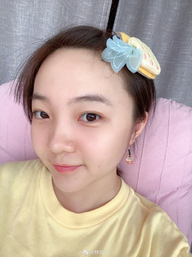 林妙可久违怼脸自拍,肉脸嘟嘟依旧可爱,超高发际线和痘痘抢镜