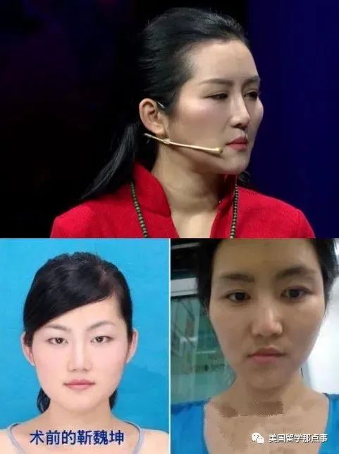 整容|未成年人|靳魏坤_新浪新闻