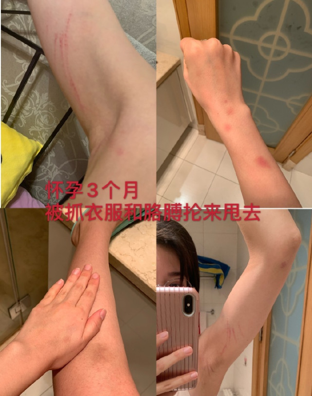 28岁美女主持人自曝因家暴离婚!去年大5岁短跑名将,孩子才1岁 28岁美女主持人自曝因家暴离婚!去年大5岁短跑名将,孩子才1岁
