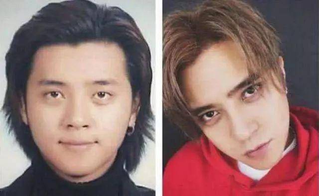 做机压双眼皮价格是多少?