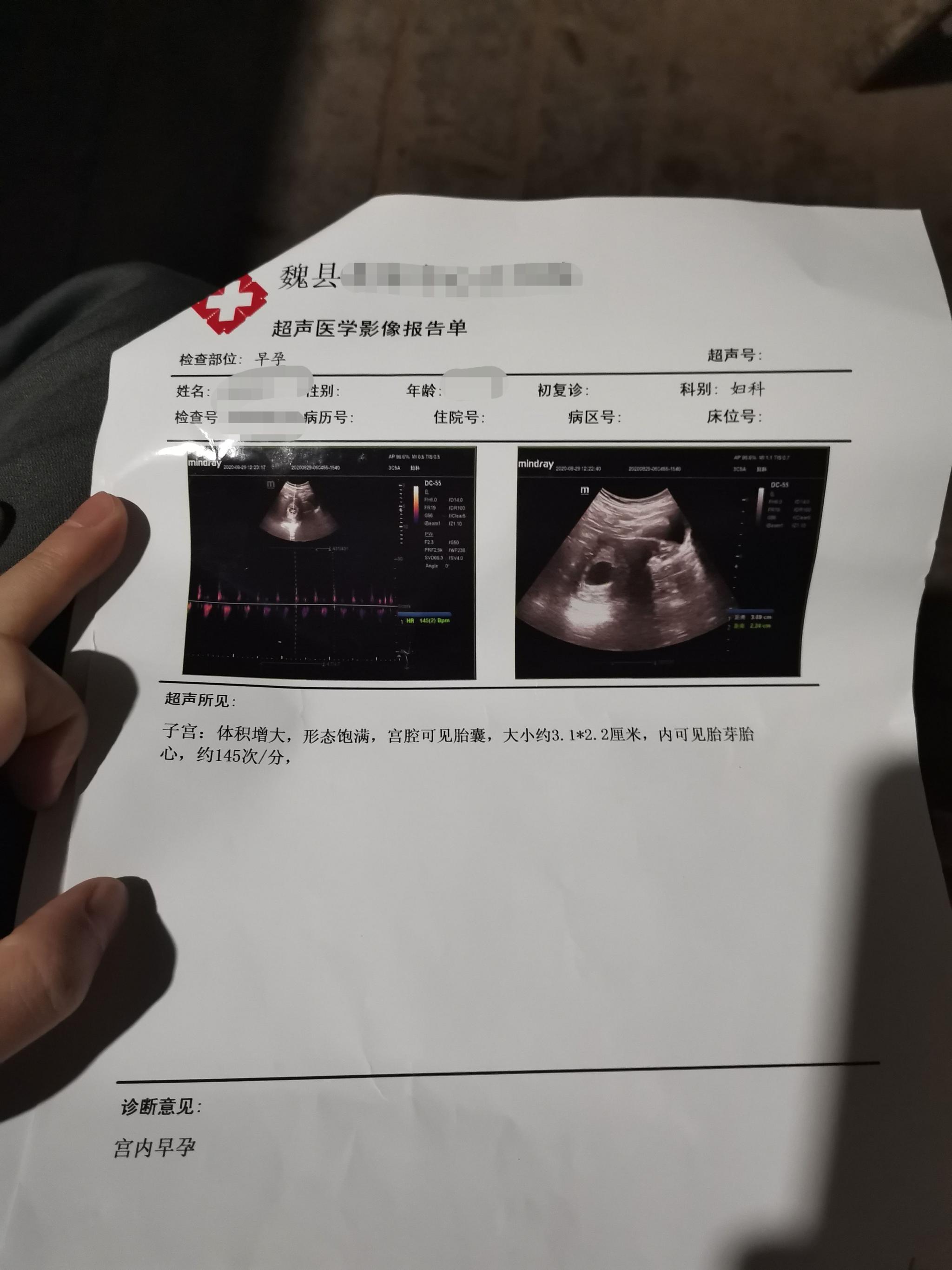晓雨怀孕的影像报告单。受访者供图