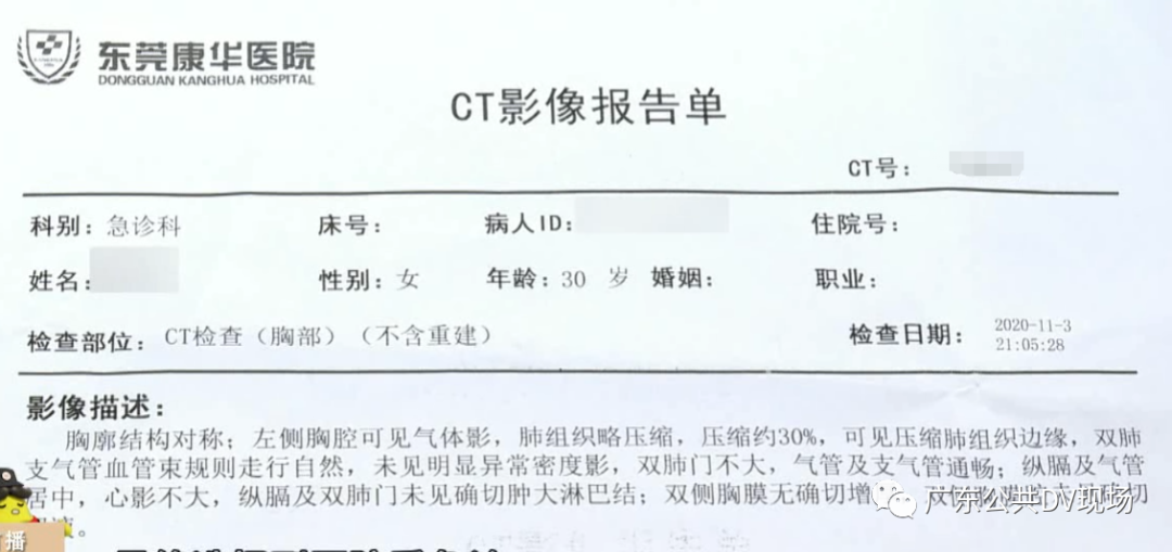 女子拔罐后胸闷气短竟是气胸这类人群要谨慎