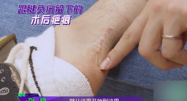刘翔罕晒跟腱术后疤痕,长达5厘米伤疤触目惊心,网友直呼心疼 刘翔罕晒跟腱术后疤痕,长达5厘米伤疤触目惊心,网友直呼心疼