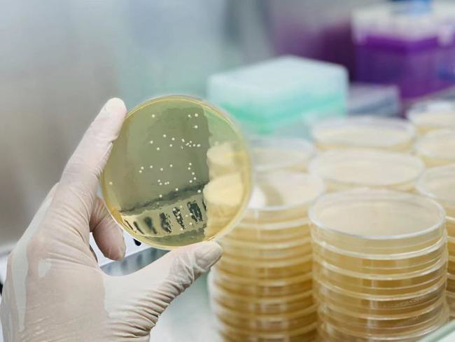 粪菌移植、预测免疫疗法,这家肠道微生态治疗公司获新融资休闲区蓝鸢梦想 - Www.slyday.coM 粪菌移植、预测免疫疗法,这家肠道微生态治疗公司获新融资休闲区蓝鸢梦想 - Www.slyday.coM