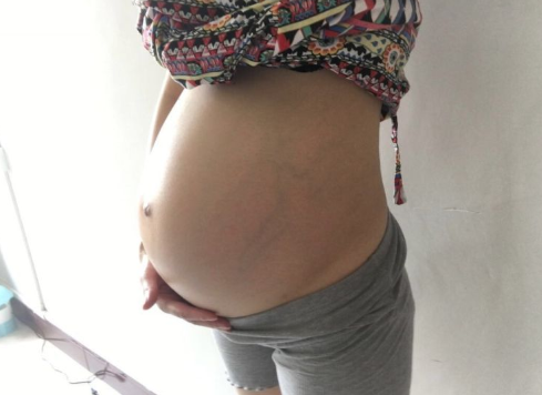 孕27周肚子不显怀，准妈妈粗略的应对，胎儿被迫早产