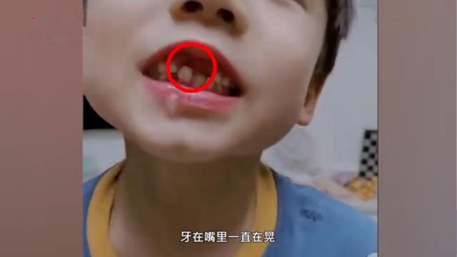 6岁小男孩用吹气的办法吹掉牙齿，网友：想到了小时候换牙的经历