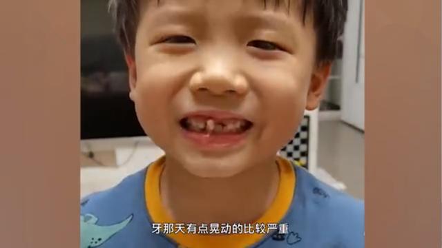 6岁小男孩用吹气的办法吹掉牙齿，网友：想到了小时候换牙的经历