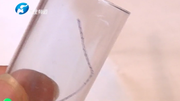 河南女子脸上长脓包吃药不见好！没想到竟然揪出一根线