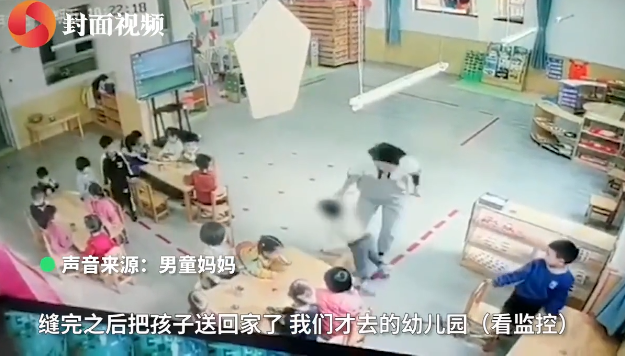 男童被幼师推倒致下巴缝八针!教育局回应休闲区蓝鸢梦想 - Www.slyday.coM 男童被幼师推倒致下巴缝八针!教育局回应休闲区蓝鸢梦想 - Www.slyday.coM