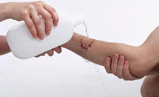 3岁男孩被邻居家狗咬身亡,孩子父亲:两家不足百米,狗常年不拴休闲区蓝鸢梦想 - Www.slyday.coM 3岁男孩被邻居家狗咬身亡,孩子父亲:两家不足百米,狗常年不拴休闲区蓝鸢梦想 - Www.slyday.coM