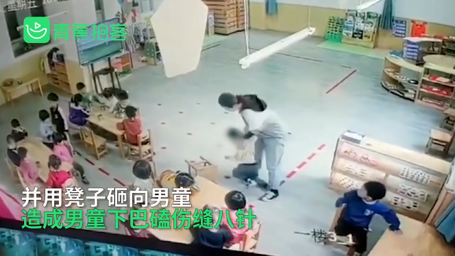 男童被幼师推倒致下巴缝八针!教育局回应休闲区蓝鸢梦想 - Www.slyday.coM 男童被幼师推倒致下巴缝八针!教育局回应休闲区蓝鸢梦想 - Www.slyday.coM