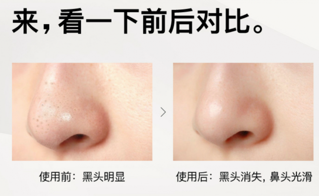 这可能是你从来没体会过的去黑头方式,实在是太舒服了