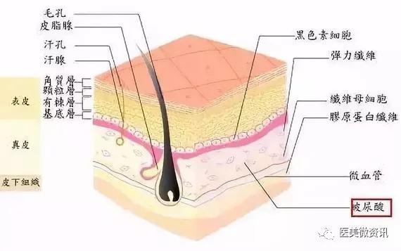 玻尿酸解决静态皱纹,肉毒素对付动态皱纹,你适合哪个?