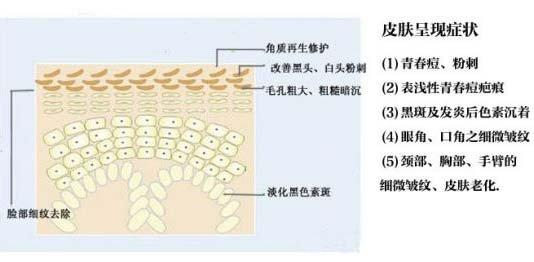 去角质必要吗?关于去角质你必须知道的一切