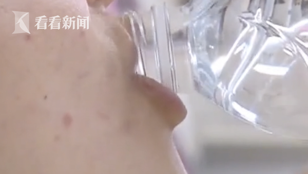 为憋尿做B超她半小时喝5瓶水 上吐下泻失去意识