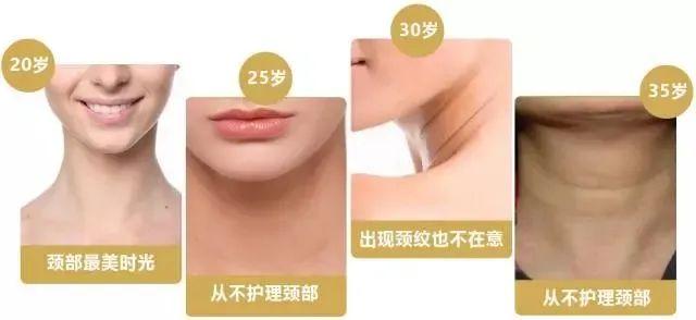 20岁的脸,30岁的颈纹!!!你知道颈部皮肤衰老比面部更难修复吗?