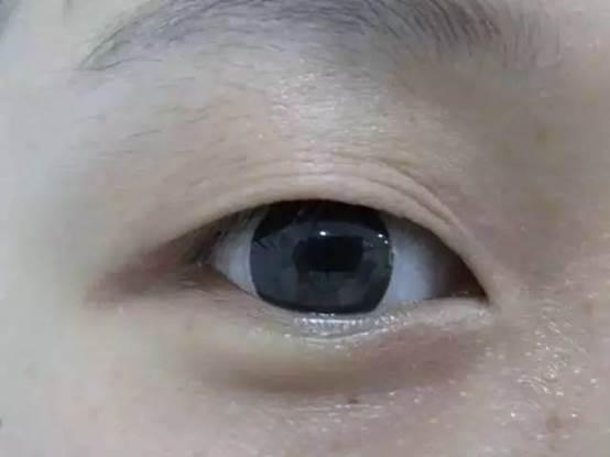 为让女儿鼻梁变挺,宝妈用尽手段,医生:整容医生都不敢这么做