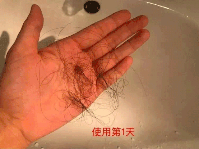 买一送一 | 3天不洗头也不痒!国家专利氨基酸洗发水,固发还强效去头屑