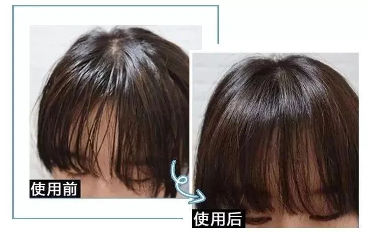 买一送一 | 3天不洗头也不痒!国家专利氨基酸洗发水,固发还强效去头屑