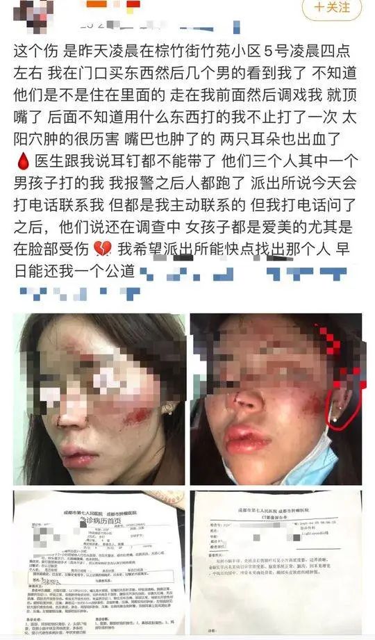 女子凌晨回家被3名陌生男子调戏殴打 警方介入调