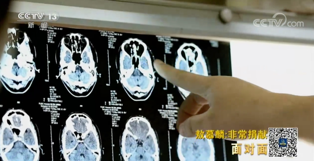 父亲因新冠肺炎离世,没想到母亲的第一句话是…… 父亲因新冠肺炎离世,没想到母亲的第一句话是……