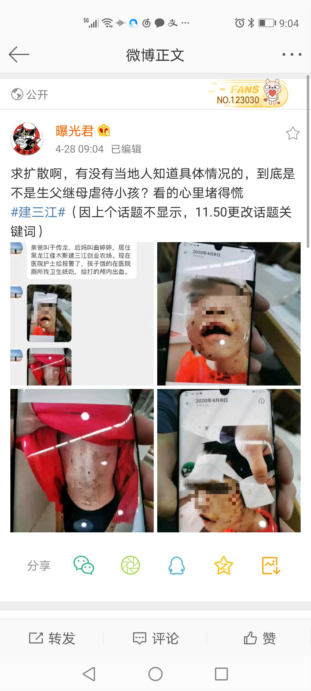 有微博网友曝光，建三江创业农场有4岁女童被虐打。 @“曝光君”微博   图