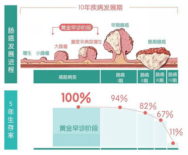 男子查出肠癌 后悔大哭 原来大便早就 提醒 自己却忽略