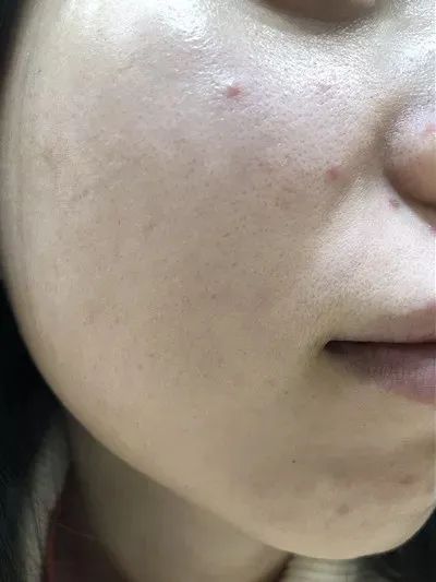 景甜花10年培养的富贵花气质 她出生就有 为啥