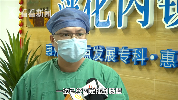 女子国外误吞牙签 强忍两个多月回国才取出