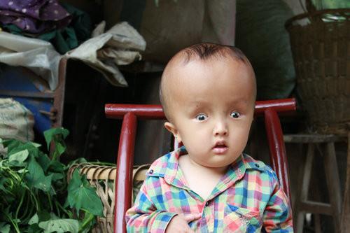 湖南郴州大头娃娃最新消息:官方称未发现医生参与假奶粉事件
