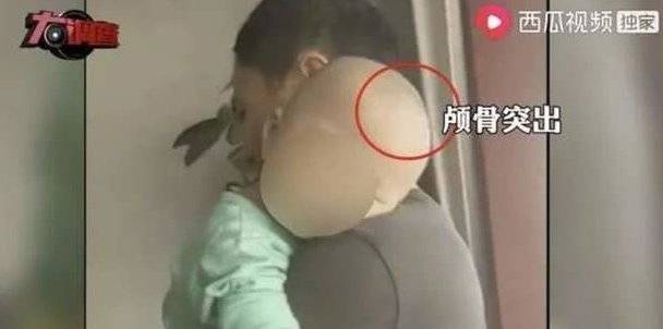 新“大头娃娃”事件背后：什么让从业者失了敬