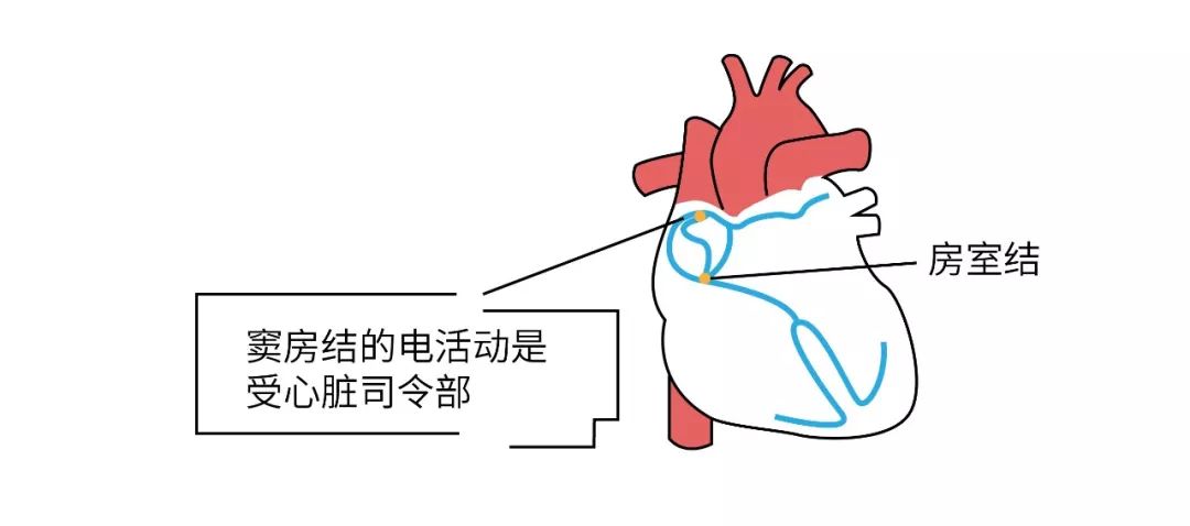 【名医】心脏不难受,为什么还要去查心电图?