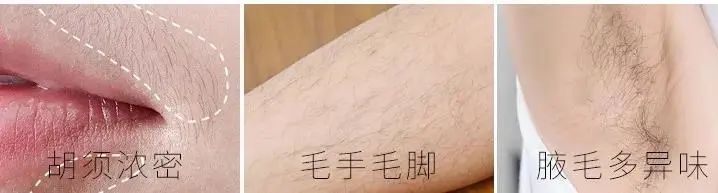 五月不脱毛,六月猕猴桃,该跟小胡子和腋毛说拜拜啦~