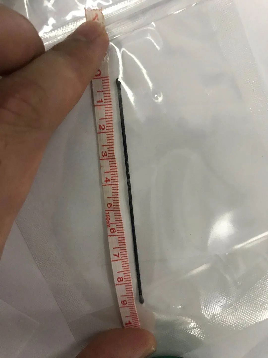 熊孩子!9厘米发卡,竟藏在14岁男童膀胱中!