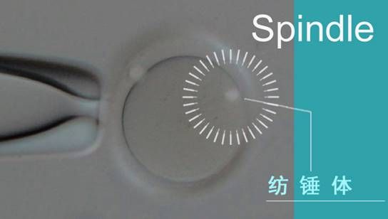 奥林巴斯显微科技 助力试管婴儿技术变革